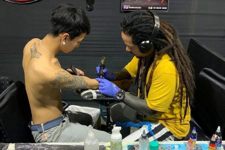 Tattoo Removal